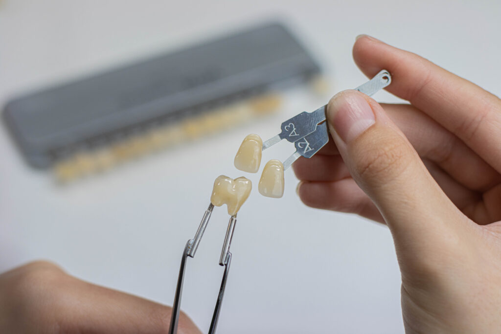 Labor Peppel Dental Technic, Implantatplanung