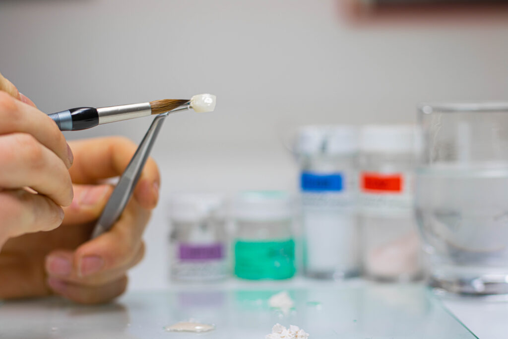 Labor Peppel Dental Technic, Vollkeramik