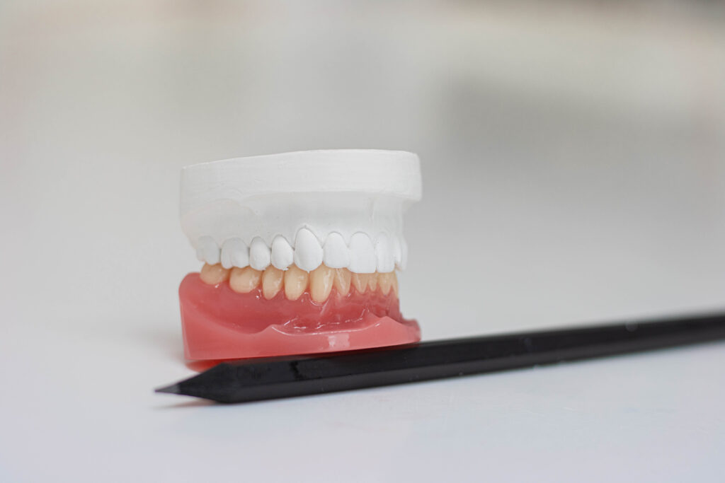 Labor Peppel Dental Technic, Metallkeramik